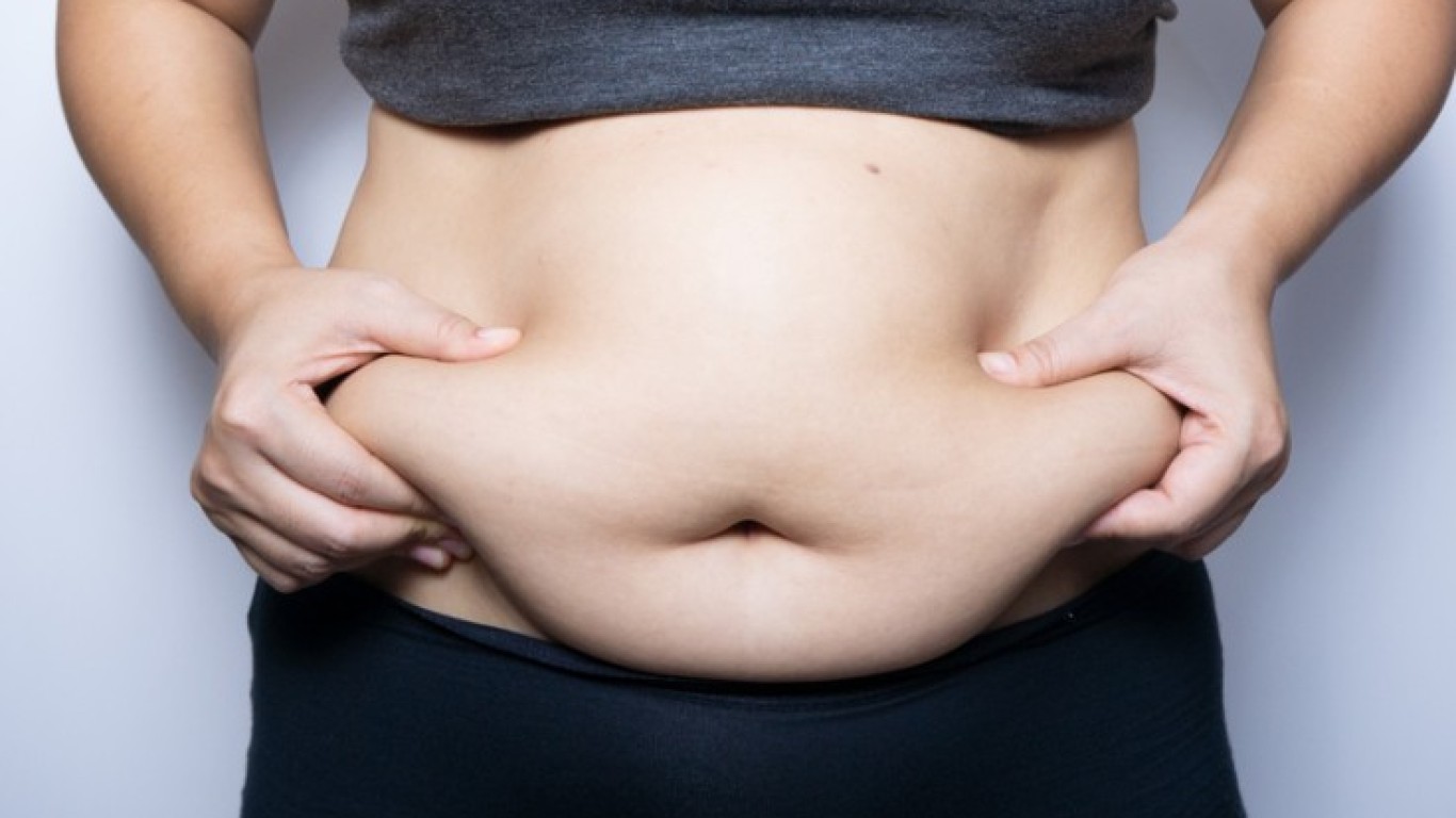 Tout ce que vous devez savoir sur la sleeve gastrectomie