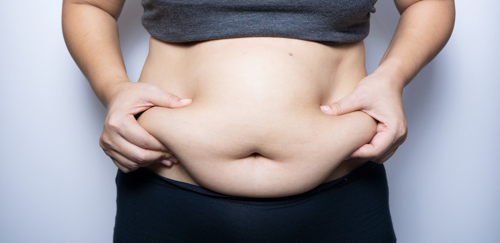 Gastric Sleeve in Turkey: What to Expect, Procedure, Cost