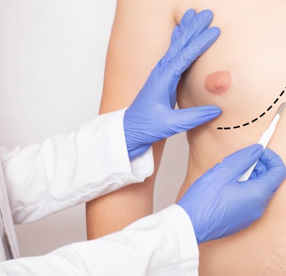 Les seins chez les hommes : Comment s'en débarrasser ?