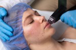 Golden Needle Treatment: What to Expect and Why Try It