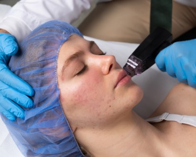 Golden Needle Treatment: What to Expect and Why Try It