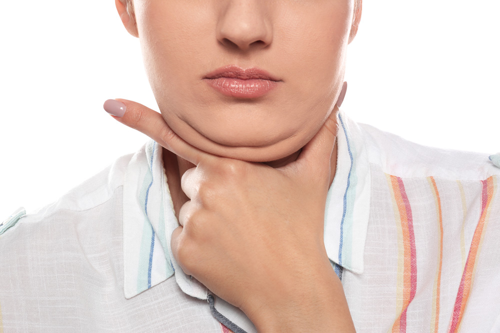 Cuidado de las cicatrices de la eliminación de grasa bucal: 10 consejos simples a seguir