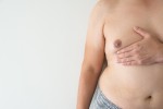 7 Common Questions About Gynecomastia