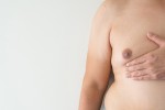 Gynecomastia in Istanbul: 5 Things to Know