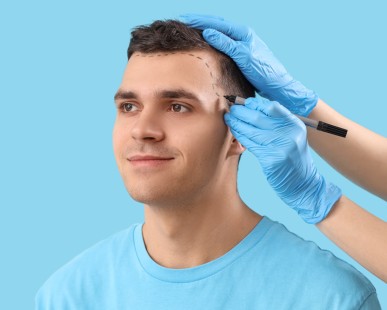 What to Expect After Hair Transplant in Turkey