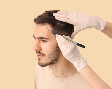 Hair Transplant in Turkey: When Will You See Full Results?