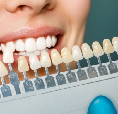 Láminas de porcelana vs. coronas de zirconio: una comparativa estética