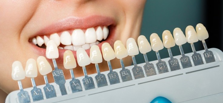 Láminas de porcelana vs. coronas de zirconio: una comparativa estética