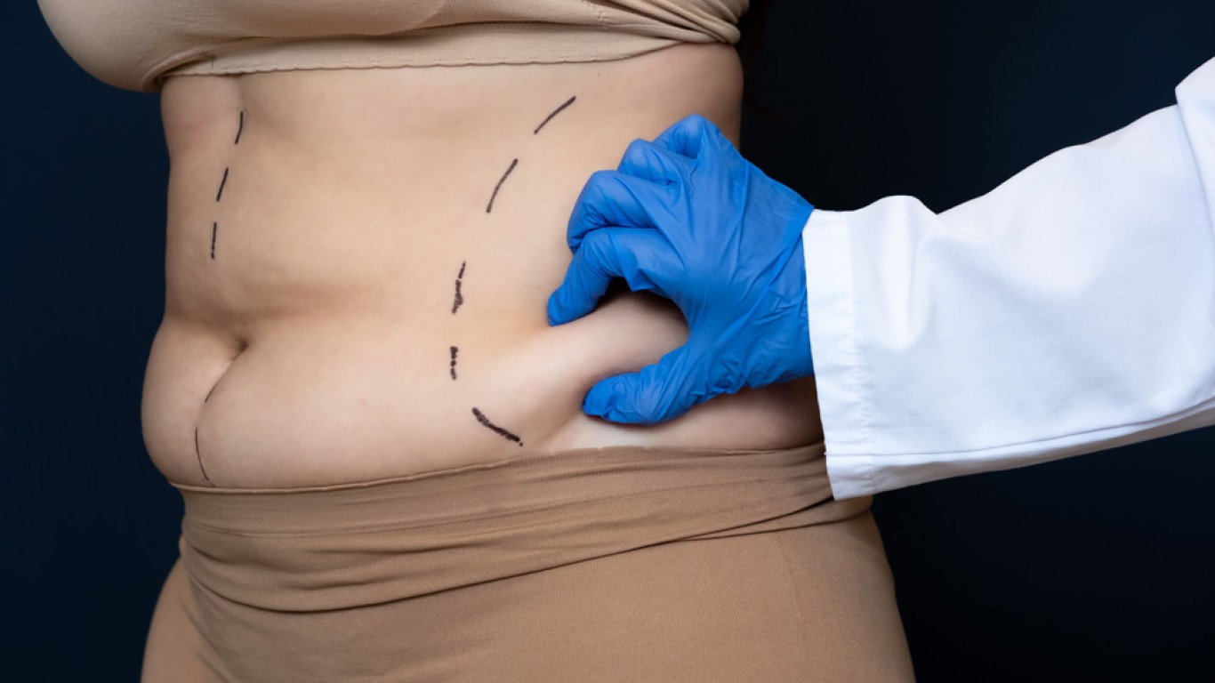 Laser-Liposuktion in der Türkei: Was erwartet Sie, Kosten, Ablauf