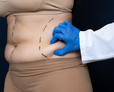 Laser Liposuction in Turkey: What To Expect, Costs, Procedure