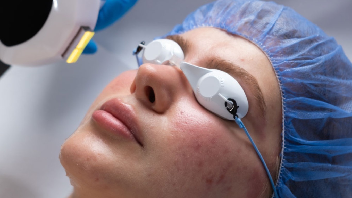 Laserbehandlungen in Istanbul: Was sind die besten Optionen?