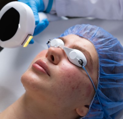 Laser Treatments