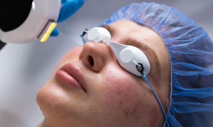 Laser Treatments in Istanbul: What Are the Top Options?