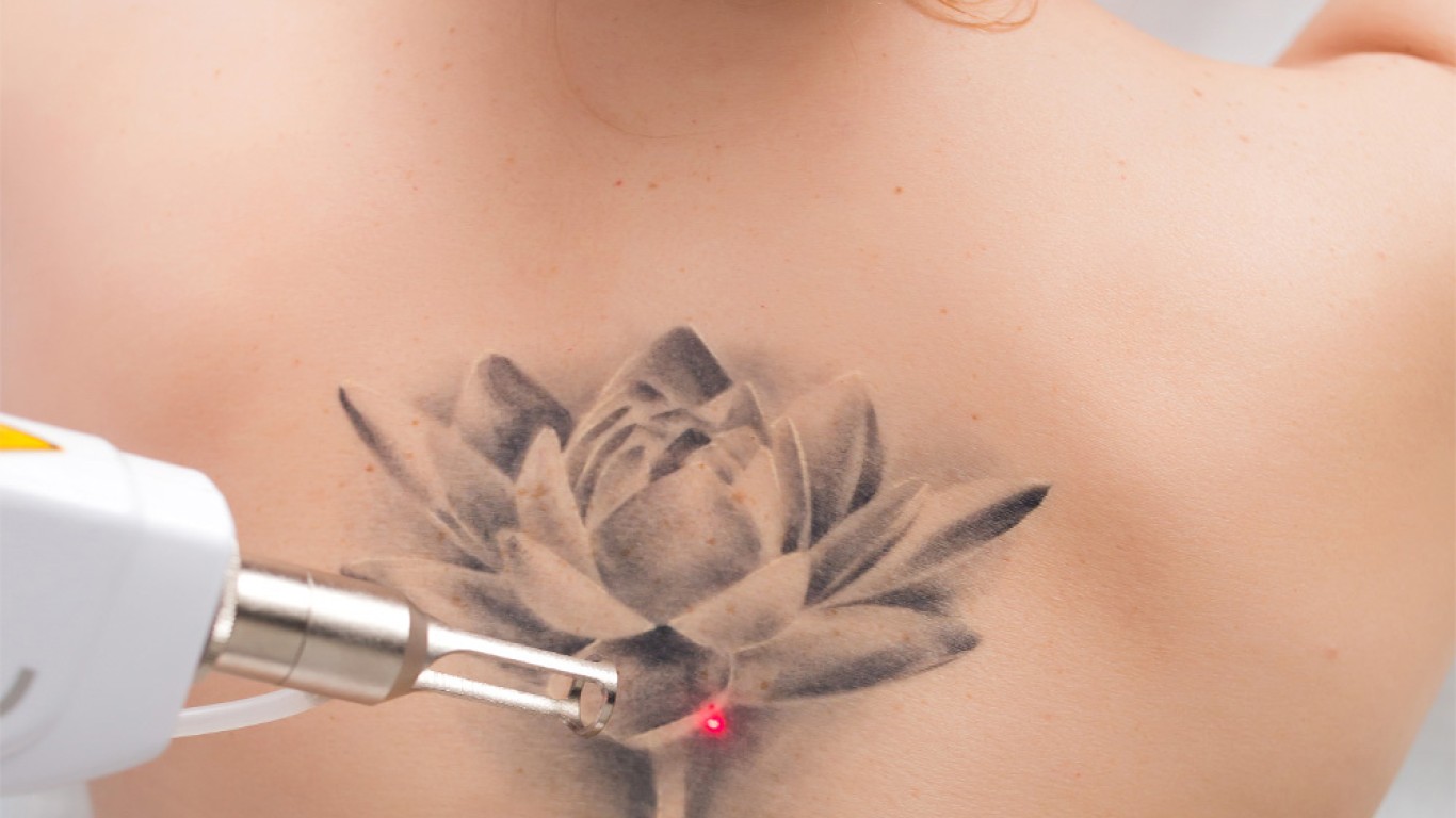 ¿Cuántas sesiones se necesitan para eliminar un tatuaje con láser?