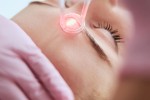 Laser Wrinkle Treatment: What It Can Do for Ageing Skin