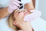 Is Laser Hair Bleaching Right for You?