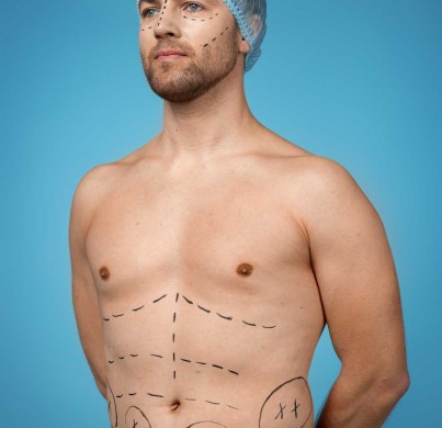 Cirugía estética de Ryan Gosling