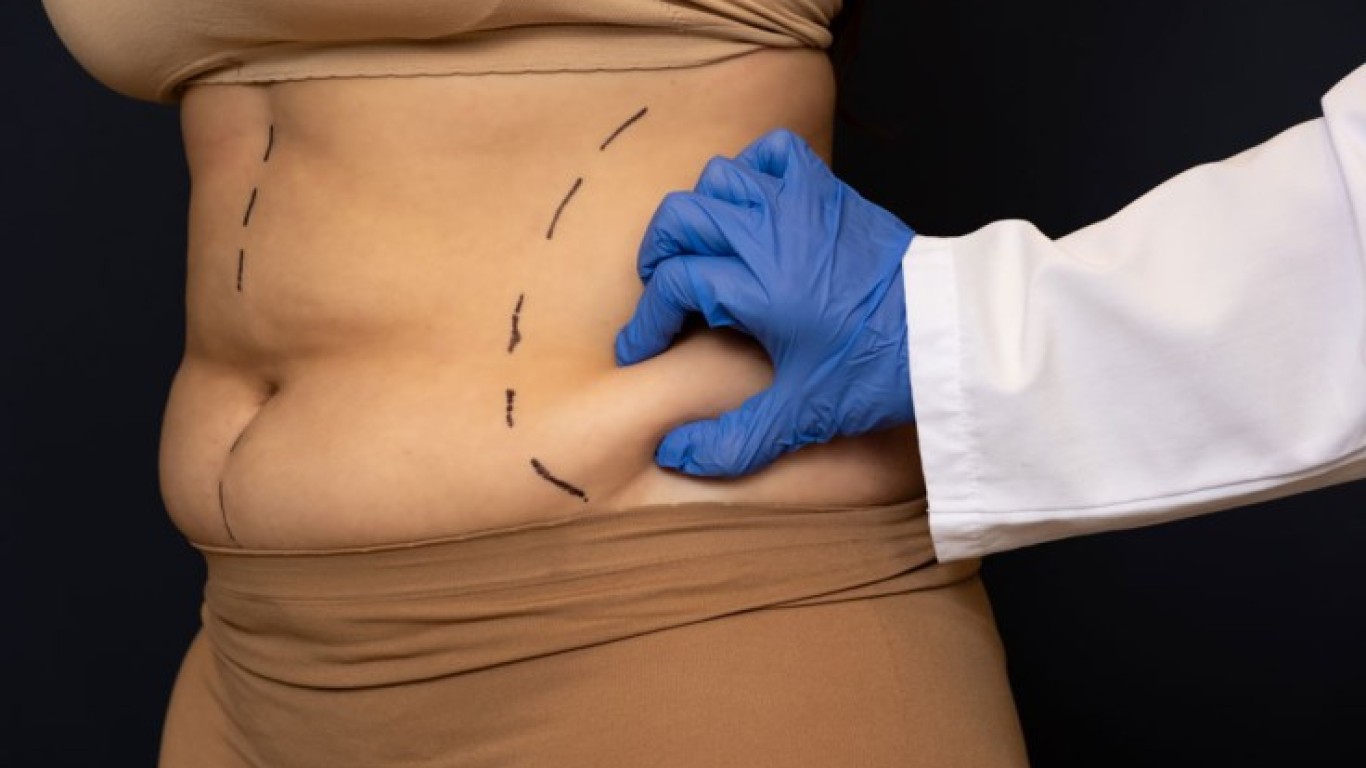 Stomach Liposuction Cost in 2026 and Treatment Scope