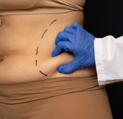 Kosten für eine Fettabsaugung am Bauch im Jahr 2026 und Behandlungsumfang