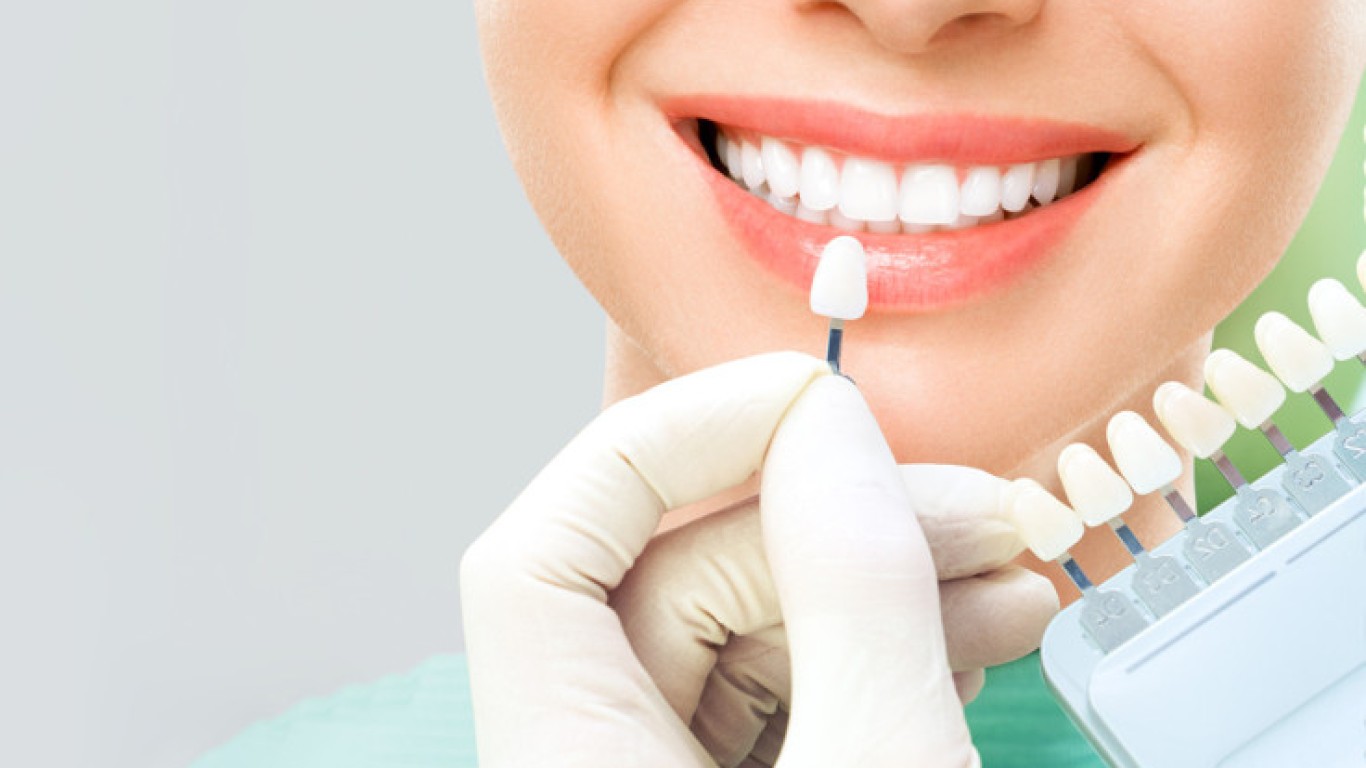 ¿Cuánto Duran las Carillas Dentales de Porcelana?