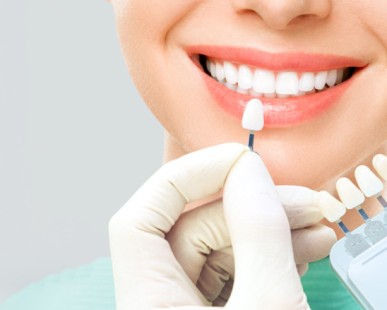 Wie lange halten Porzellan-Veneers?