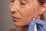 PRP for Under Eyes: How to Enhance the Appearance?