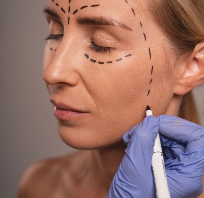 Mesotherapy Injections Explained in Simple Terms