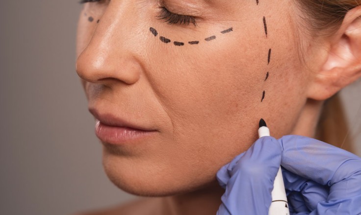 PRP for Under Eyes: How to Enhance the Appearance?