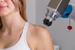 Everything You Need to Know About Mole Removal