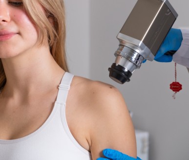 Mole Removal