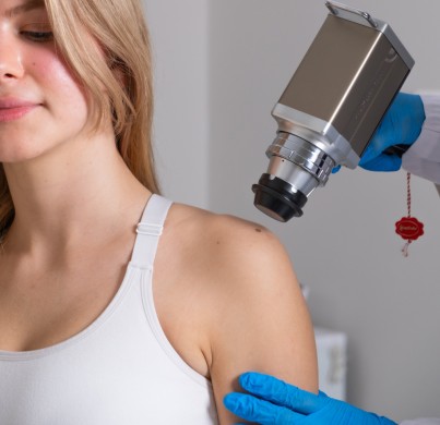 Mole Removal
