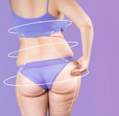 Mommy Makeover : les 4 combinaisons les plus demandées