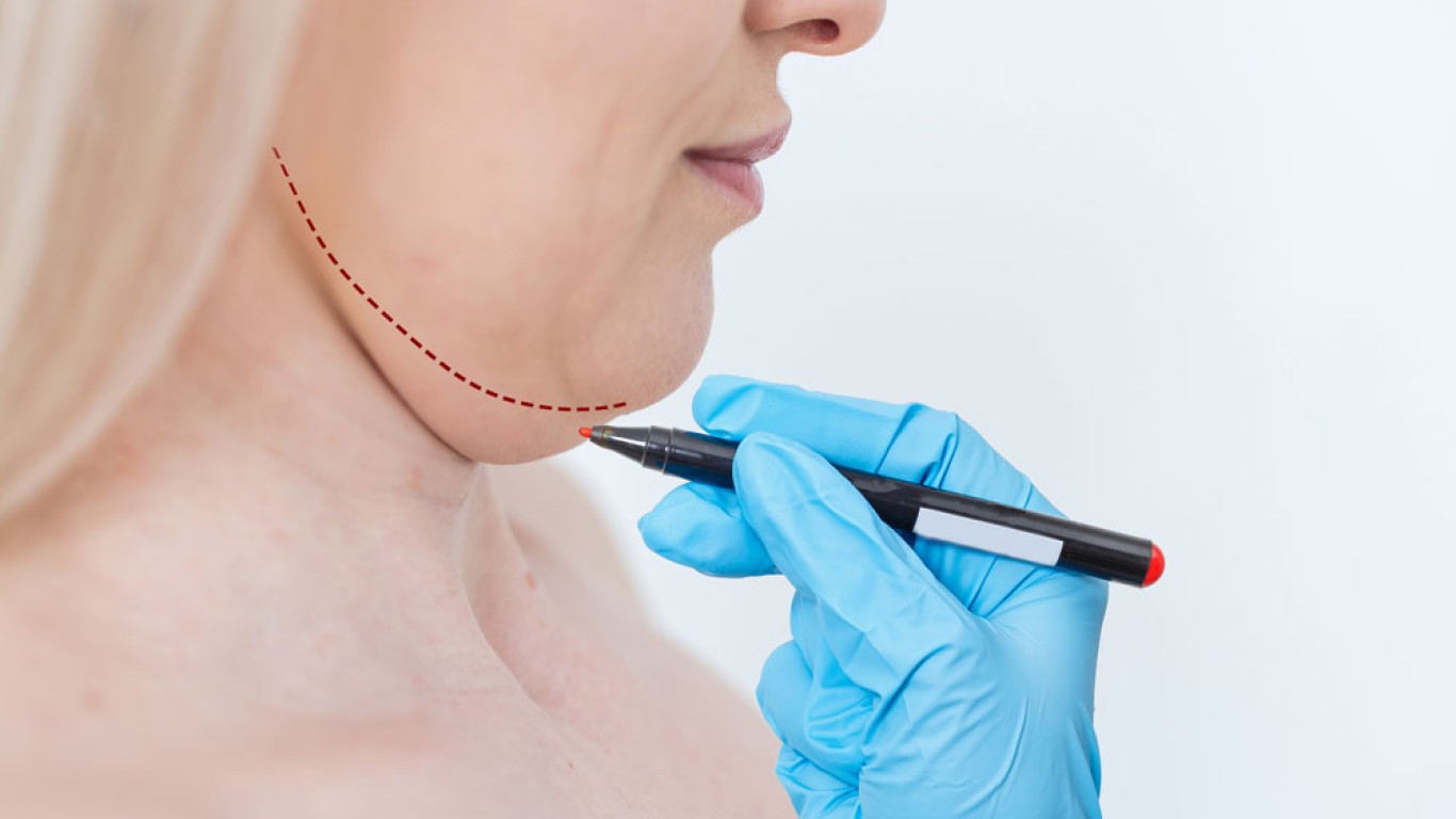 Hals-Liposuktion vs. Hals-Lifting: Was ist der Unterschied?