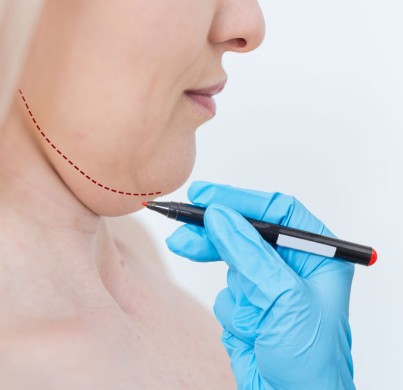 Quelle est la différence entre la liposuccion du cou et le lifting du cou?