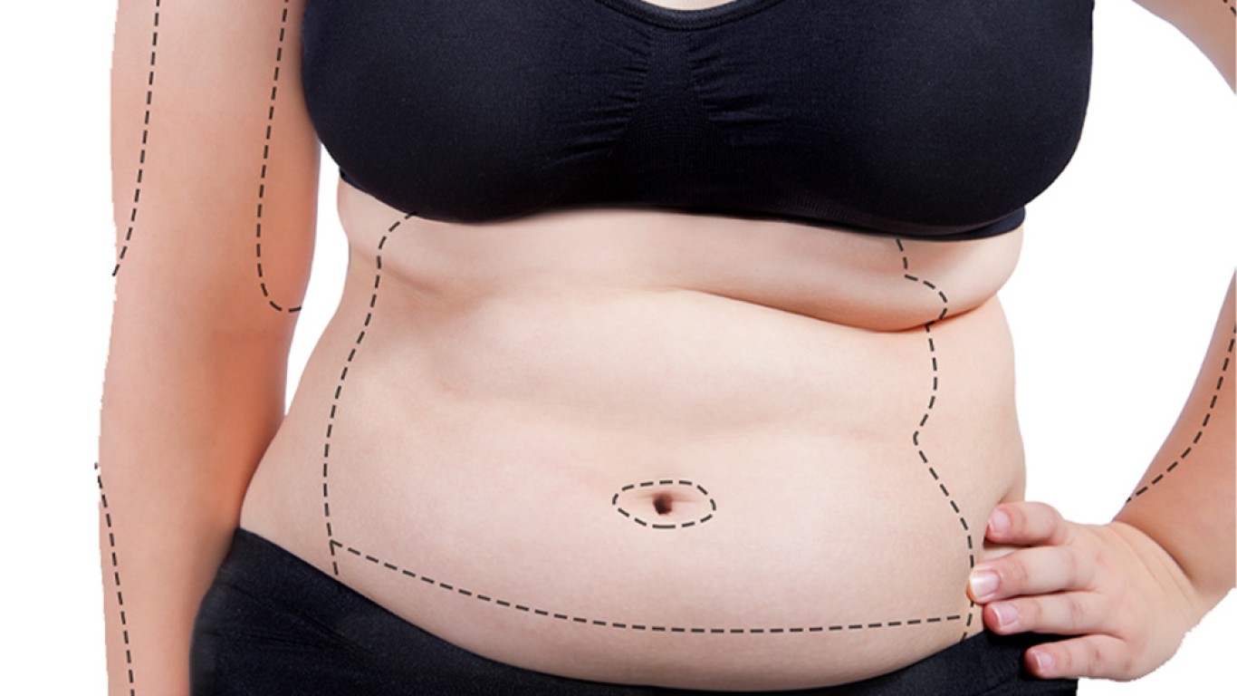 Bariatrische Chirurgie: Wie viel Gewicht werde ich verlieren?