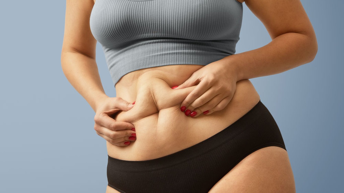 7 causas de la obesidad