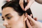 Otoplasty in Istanbul: What to Expect, Procedure, Cost