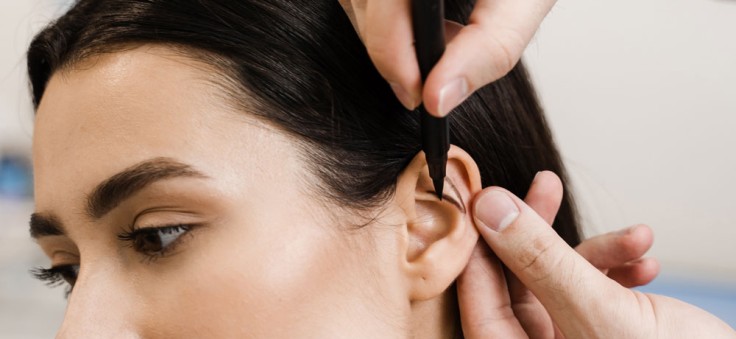 Otoplasty in Istanbul: What to Expect, Procedure, Cost