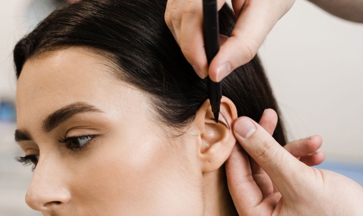 Otoplasty in Istanbul: What to Expect, Procedure, Cost
