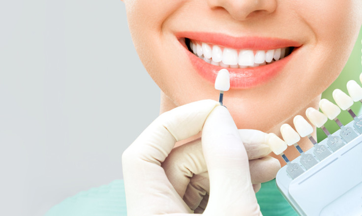 8 Things to Know Before Getting Porcelain Veneers