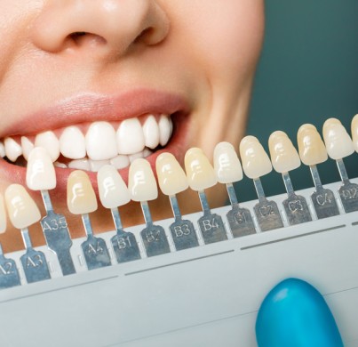 Porzellan Veneers vs. Zirkonkronen: Was ist der Unterschied?