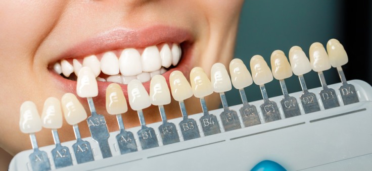 Porzellan Veneers vs. Zirkonkronen: Was ist der Unterschied?