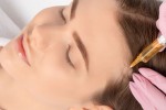 PRP for Hair Restoration in Turkey
