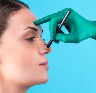 Rinoplastia de revisión en Turquía: qué es, precio y procedimiento