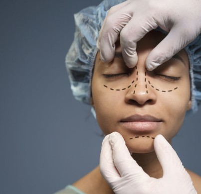 Rhinoplastie : 5 mythes courants démystifiés