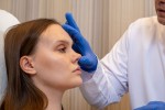 Rinoplastia: Cómo elegir la forma adecuada para su rostro