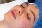 Treatments That Restore Even Skin Tone for Hyperpigmentation