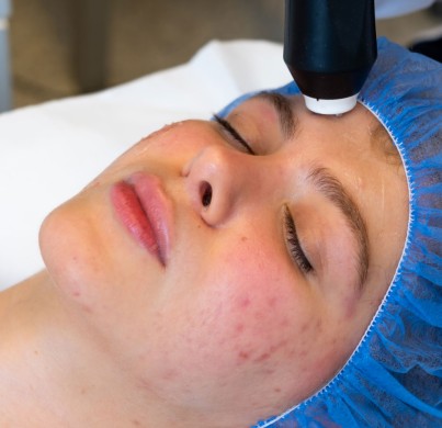 Treatments That Restore Even Skin Tone for Hyperpigmentation