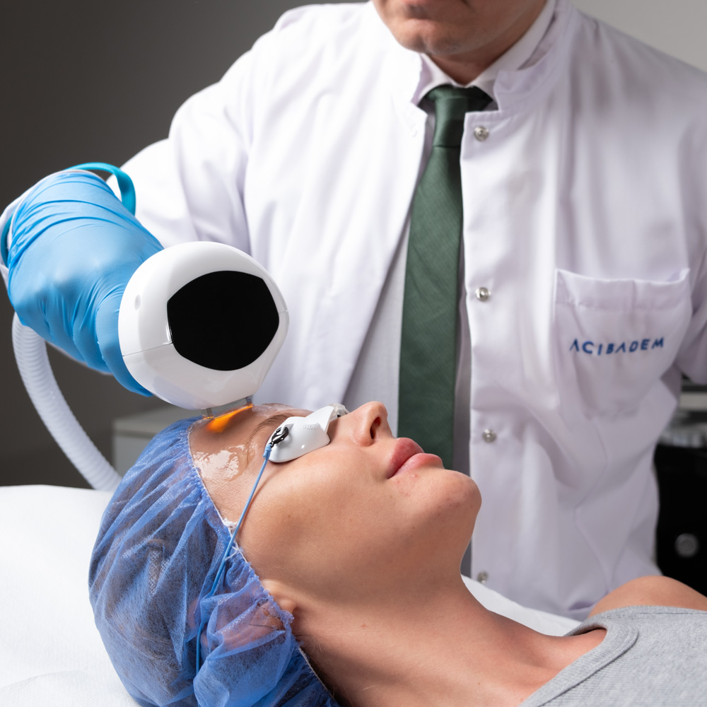 Is Dermapen or Carbon Peeling Better for Acne Scars?