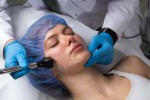 Laser Skin Tightening: Is It Right for Your Skin Goals?